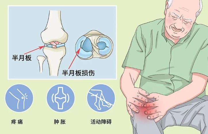 邵陽創(chuàng)傷骨科,邵陽風濕病區(qū),邵陽骨質(zhì)增生,邵陽關節(jié)病區(qū),邵陽頸椎病區(qū)