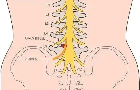 邵陽(yáng)創(chuàng)傷骨科,邵陽(yáng)風(fēng)濕病區(qū),邵陽(yáng)骨質(zhì)增生,邵陽(yáng)關(guān)節(jié)病區(qū),邵陽(yáng)頸椎病區(qū)