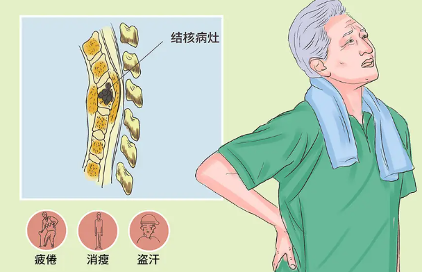 邵陽創(chuàng)傷骨科,邵陽風濕病區(qū),邵陽骨質(zhì)增生,邵陽關(guān)節(jié)病區(qū),邵陽頸椎病區(qū)